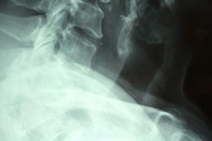 РИАН: обнаружена новая причина возникновения рака — мутации начинаются внутри