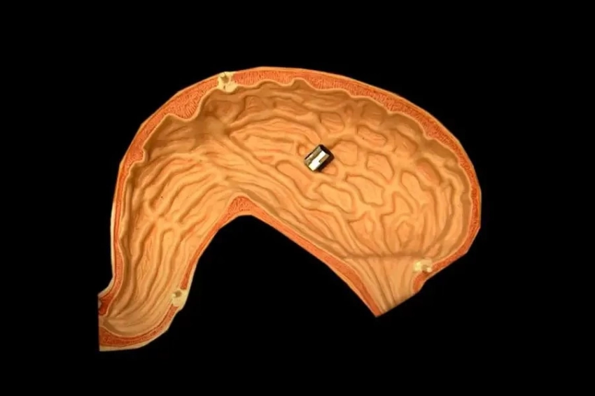 Крошечный робот может остановить кровотечение изнутри тела с помощью тепла