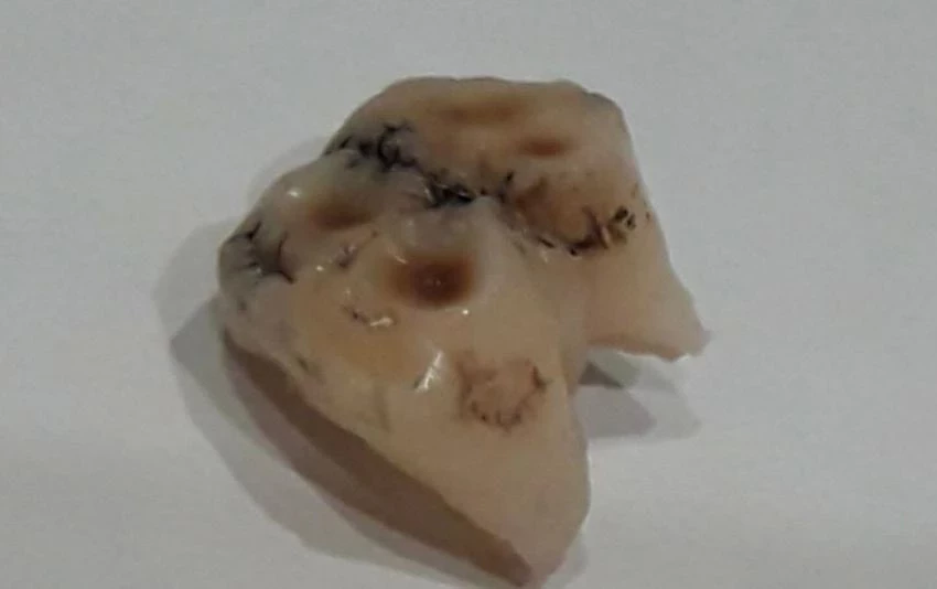 В Тюменской области женщина нашла зуб в магазинном холодце