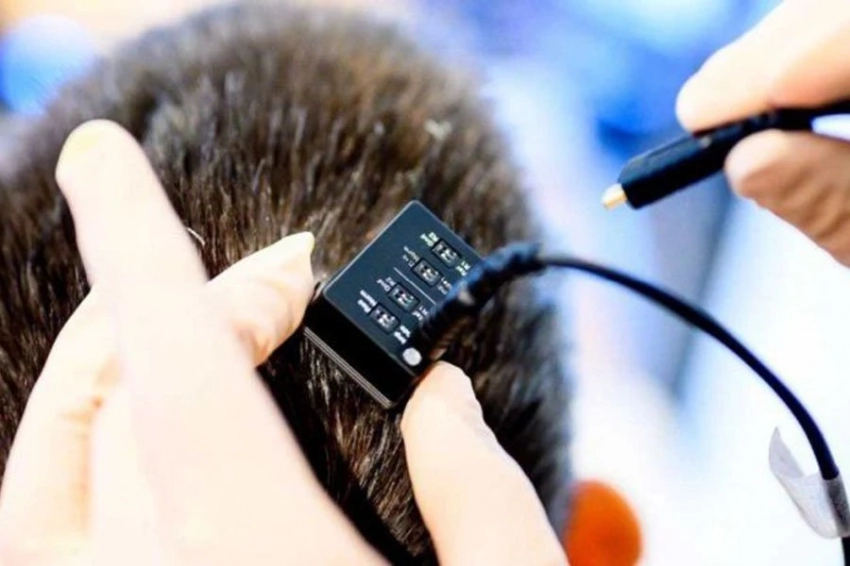 Nature: удивительный мозговой имплантат дает голос людям, которые годами не могли говорить