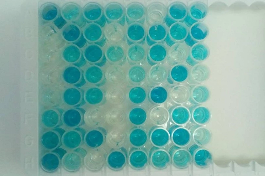 Биологи выяснили, как антитела «разрезают на кусочки» поверхностный белок коронавируса 