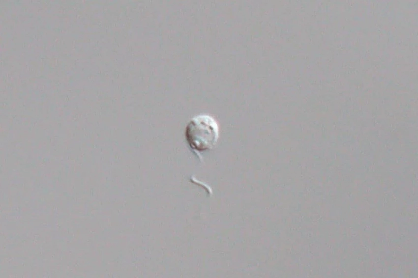 Ученые открыли три новых вида Minorisa, самого маленького хищного морского пикопланктона