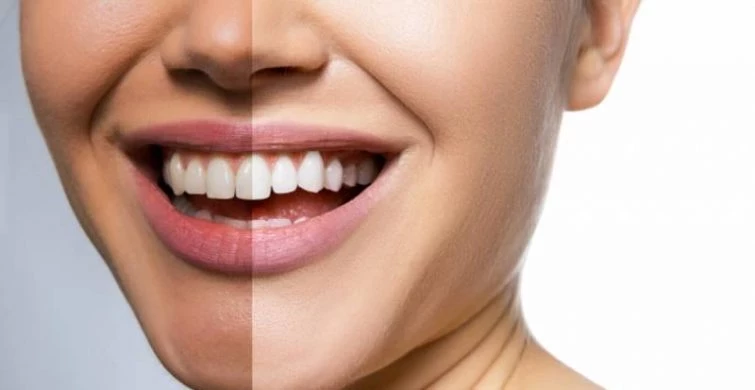 Фрукторианство, кето и веганство: влияние популярных диет на здоровье зубов