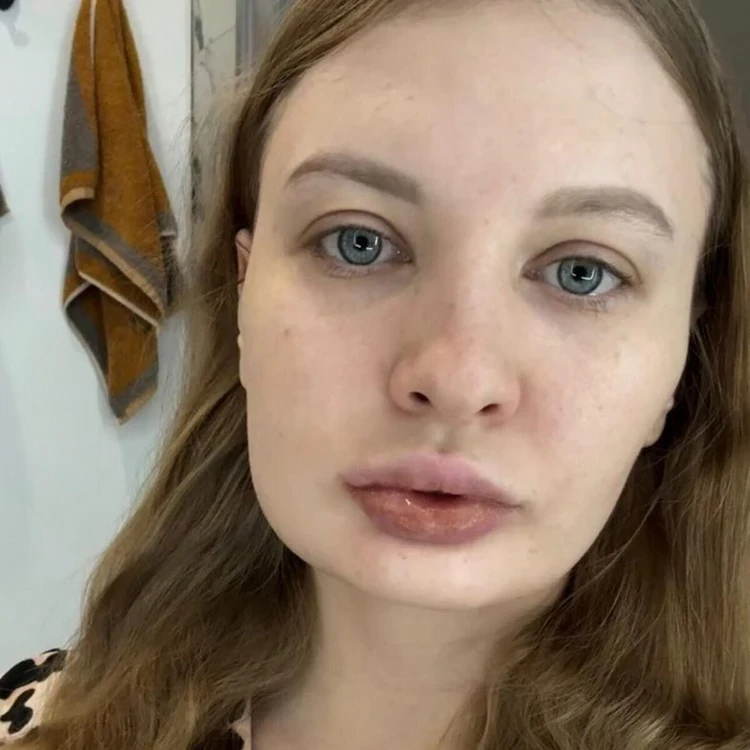 Наташа Королева выложит 10 млн рублей на операцию по изменению внешности своей невестки-стриптизерши