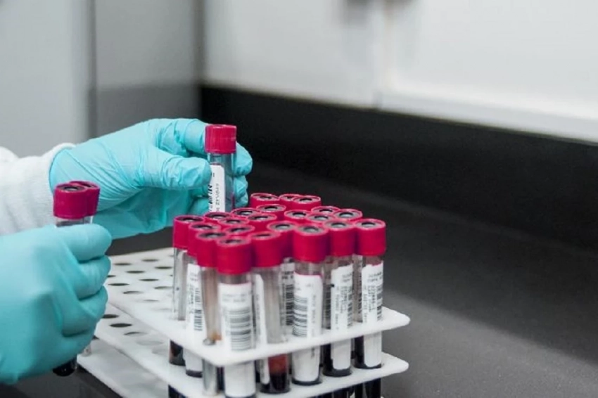 Вирус Кэмп-Хилл может спровоцировать масштабную эпидемию в Америке