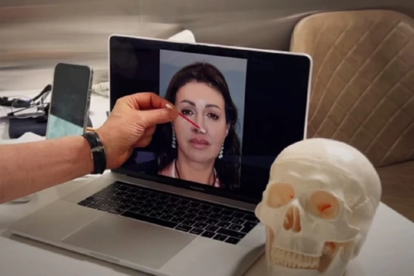 Хирург Алисы Казьминой рассказал, как будет выглядеть ее нос после 13-й операции