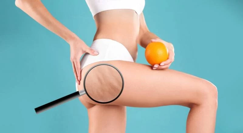 Забудь о целлюлите: Бьюти-эксперт поделилась мега эффективными процедурами