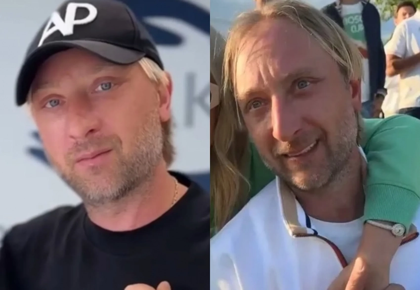 Яна Рудковская показала, как Евгений Плющенко выглядит спустя месяц после блефаропластики
